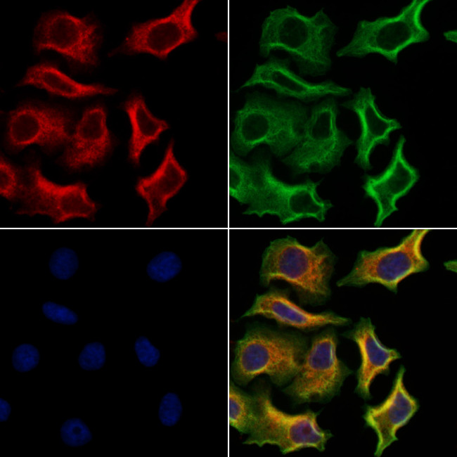 TSH Receptor Antibody in Immunocytochemistry (ICC/IF)