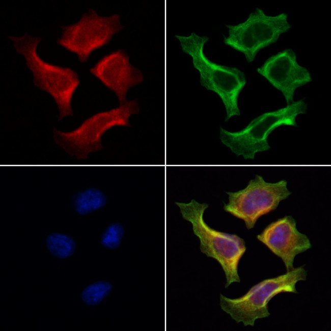 TTC7A Antibody in Immunocytochemistry (ICC/IF)