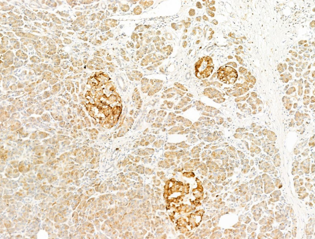 TTC7A Antibody in Immunohistochemistry (Paraffin) (IHC (P))