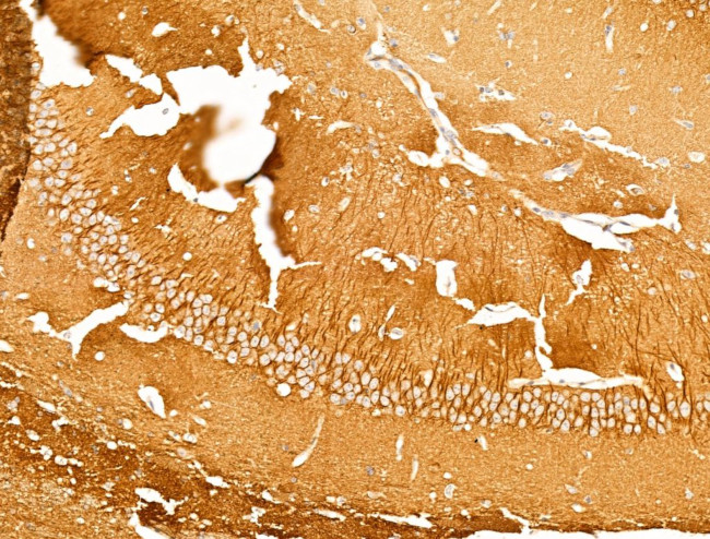 TTC7A Antibody in Immunohistochemistry (Paraffin) (IHC (P))