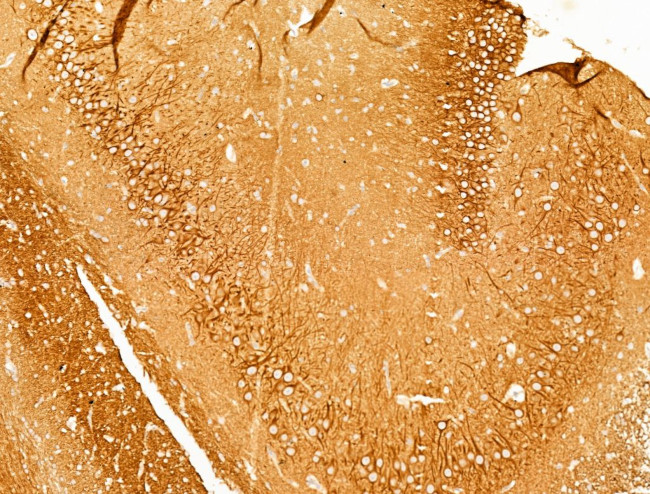 TTC7A Antibody in Immunohistochemistry (Paraffin) (IHC (P))