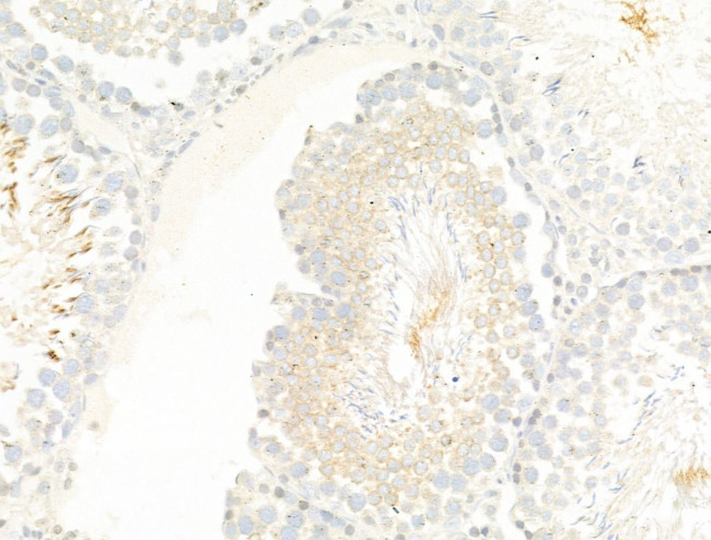 TTC7A Antibody in Immunohistochemistry (Paraffin) (IHC (P))