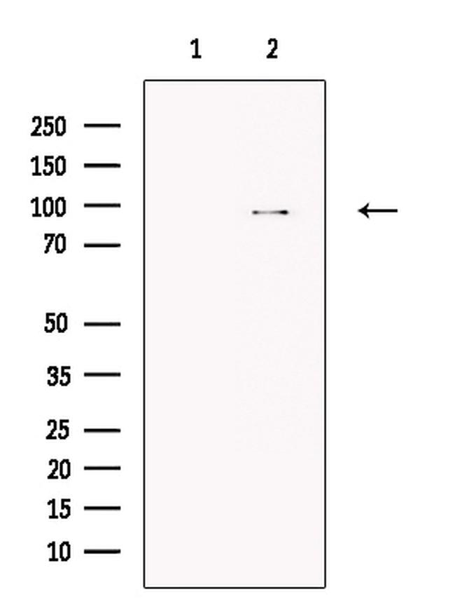 TTC7A Antibody in Western Blot (WB)