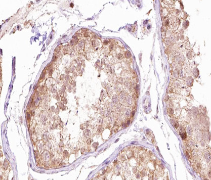 gamma Tubulin Antibody in Immunohistochemistry (Paraffin) (IHC (P))