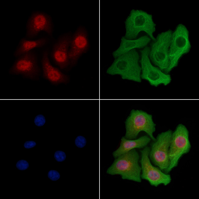 TUT1 Antibody in Immunocytochemistry (ICC/IF)