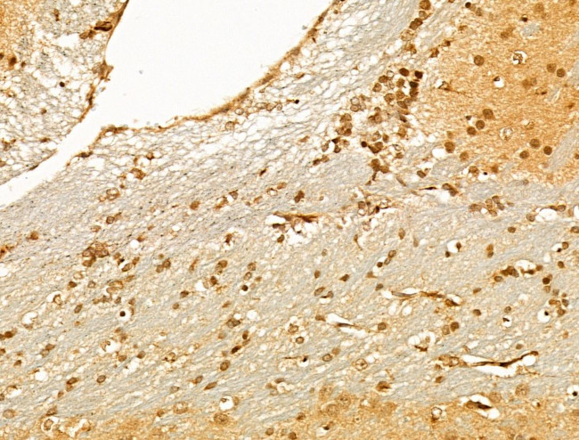 TUT1 Antibody in Immunohistochemistry (Paraffin) (IHC (P))