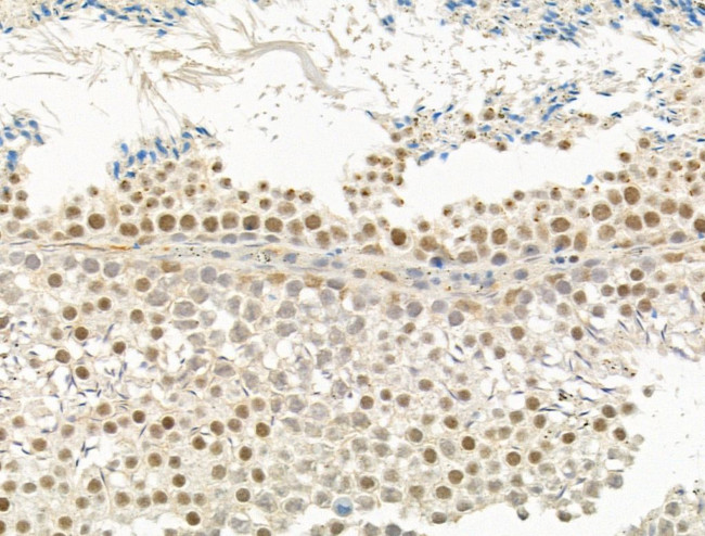 TUT1 Antibody in Immunohistochemistry (Paraffin) (IHC (P))