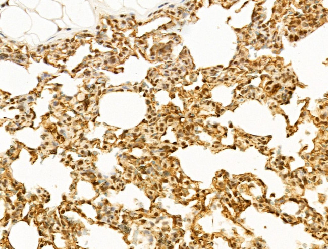 TUT1 Antibody in Immunohistochemistry (Paraffin) (IHC (P))