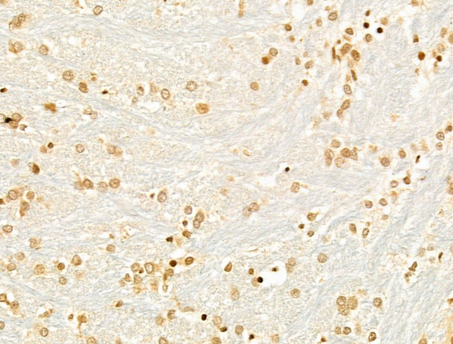 TUT1 Antibody in Immunohistochemistry (Paraffin) (IHC (P))