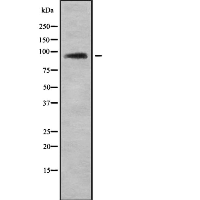 TUT1 Antibody in Western Blot (WB)