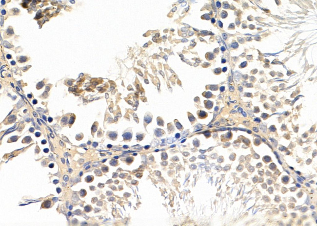 UBA3 Antibody in Immunohistochemistry (Paraffin) (IHC (P))