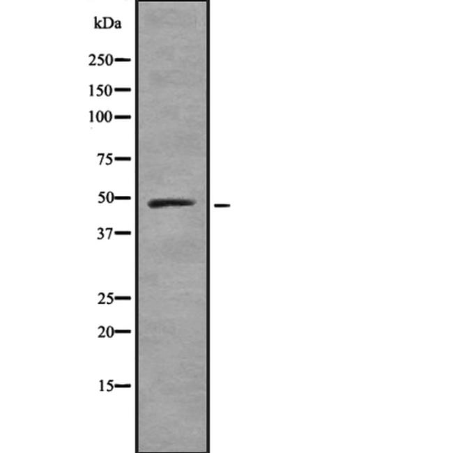 UBA3 Antibody in Western Blot (WB)