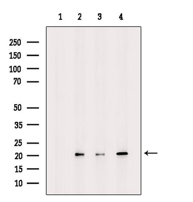 UBE2G1 Antibody in Western Blot (WB)