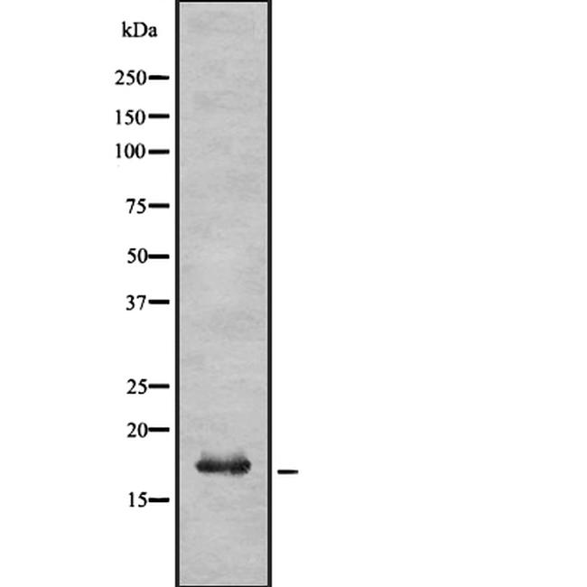 UBE2L6 Antibody in Western Blot (WB)