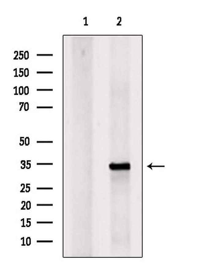 UCP1 Antibody in Western Blot (WB)