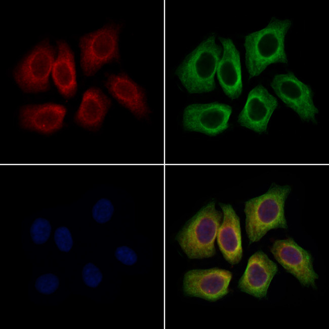 Kindlin 3 Antibody in Immunocytochemistry (ICC/IF)