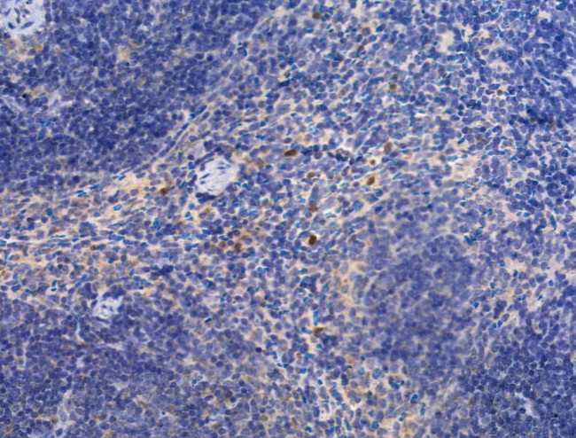 Kindlin 3 Antibody in Immunohistochemistry (Paraffin) (IHC (P))