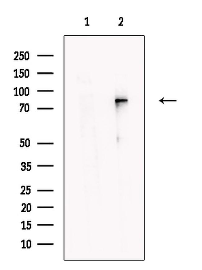 Kindlin 3 Antibody in Western Blot (WB)