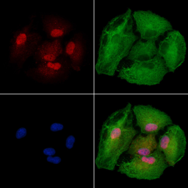 USP35 Antibody in Immunocytochemistry (ICC/IF)