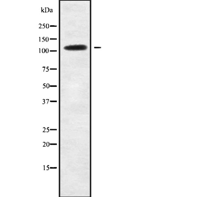 USP35 Antibody in Western Blot (WB)