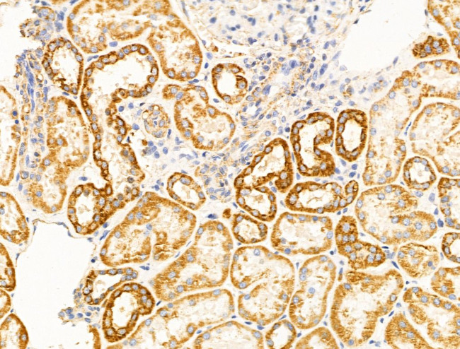 VDAC2 Antibody in Immunohistochemistry (Paraffin) (IHC (P))