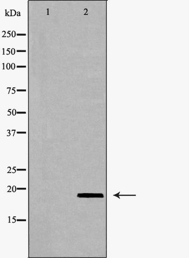 VEGFB Antibody in Western Blot (WB)