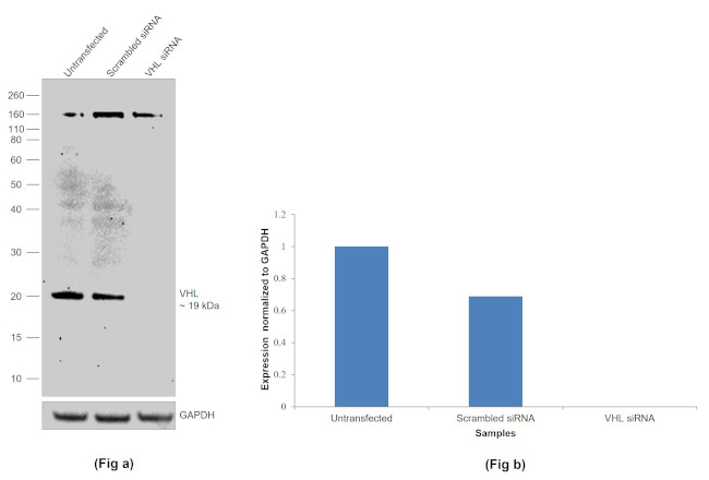 VHL Antibody in Western Blot (WB)