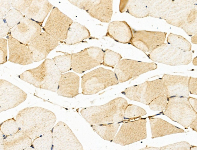 VLDLR Antibody in Immunohistochemistry (Paraffin) (IHC (P))