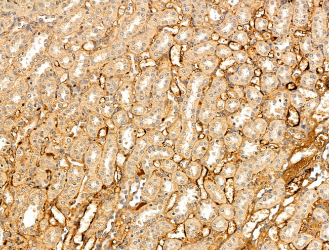 VLDLR Antibody in Immunohistochemistry (Paraffin) (IHC (P))