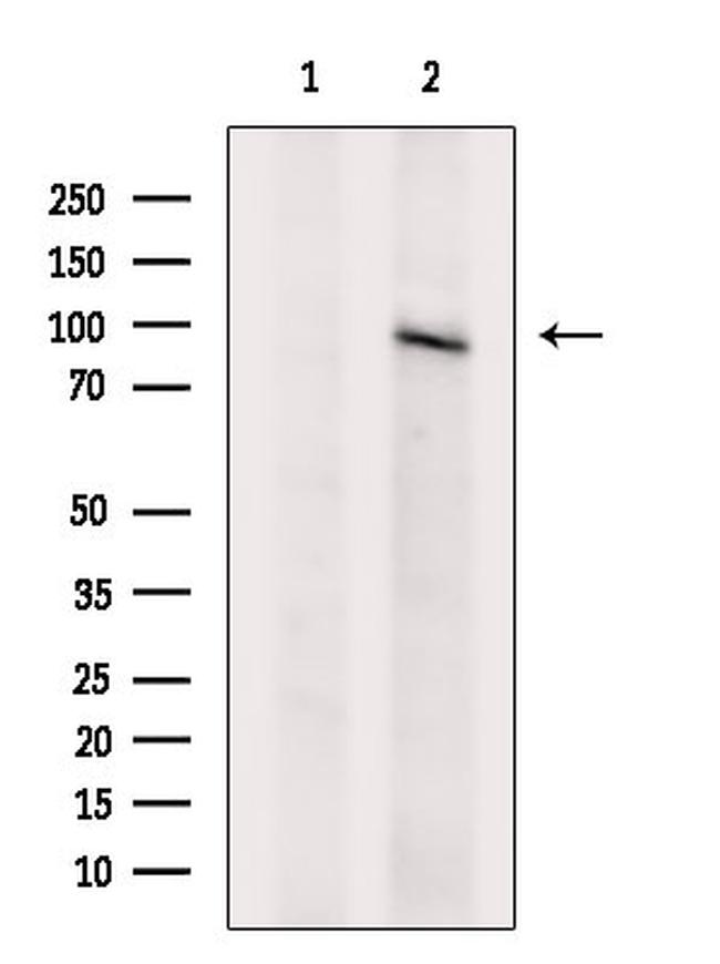 VLDLR Antibody in Western Blot (WB)