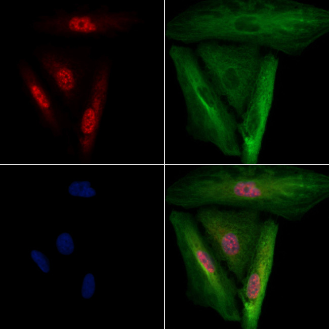 CHX10 Antibody in Immunocytochemistry (ICC/IF)