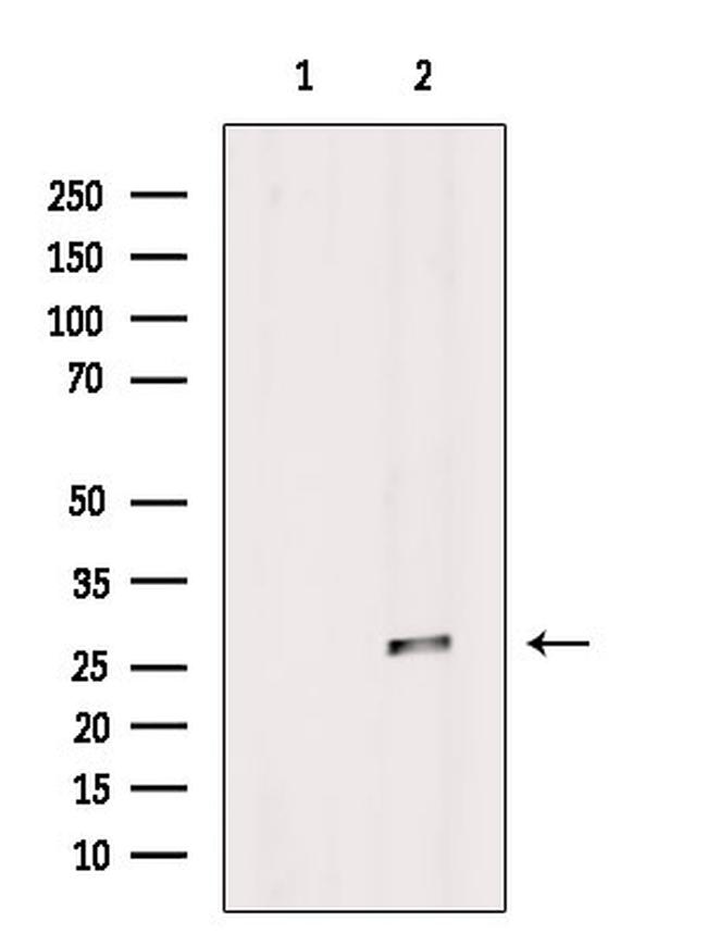 VTI1B Antibody in Western Blot (WB)