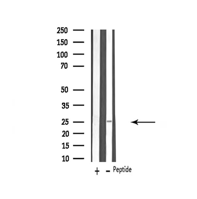 VTI1B Antibody in Western Blot (WB)