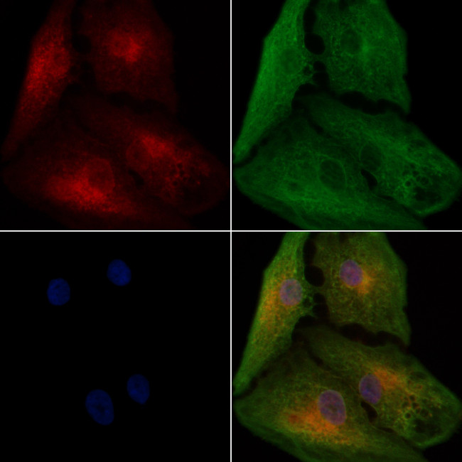 WARS Antibody in Immunocytochemistry (ICC/IF)