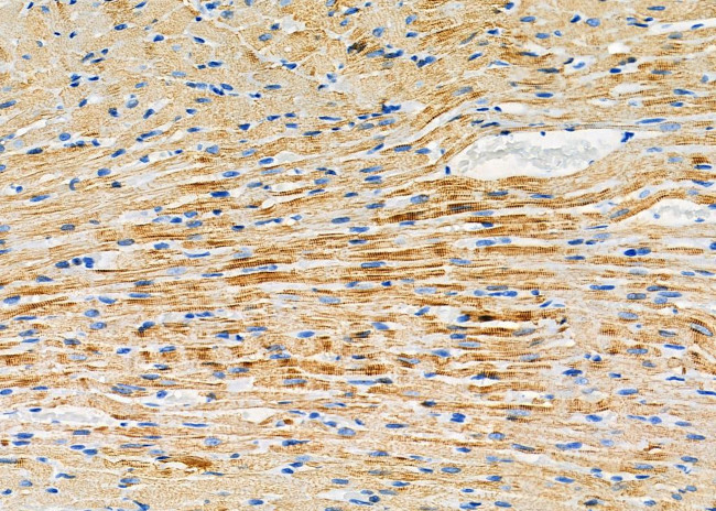 WARS Antibody in Immunohistochemistry (Paraffin) (IHC (P))