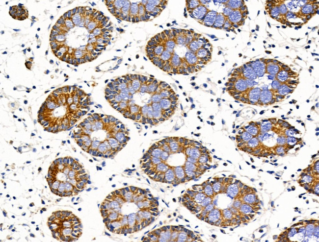 WIPI1 Antibody in Immunohistochemistry (Paraffin) (IHC (P))