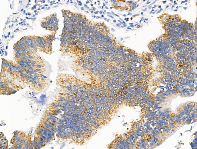 WIPI1 Antibody in Immunohistochemistry (Paraffin) (IHC (P))