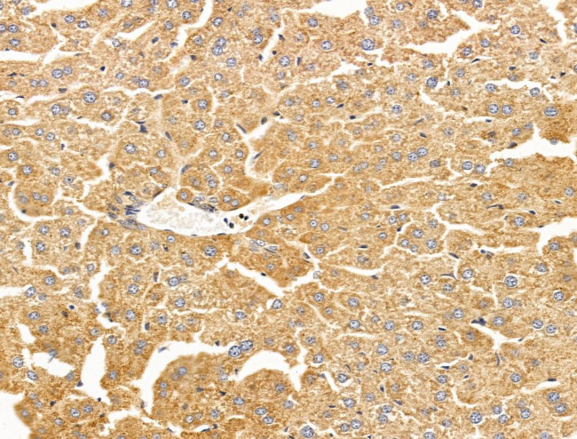 WIPI1 Antibody in Immunohistochemistry (Paraffin) (IHC (P))