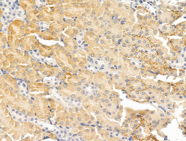 WIPI1 Antibody in Immunohistochemistry (Paraffin) (IHC (P))