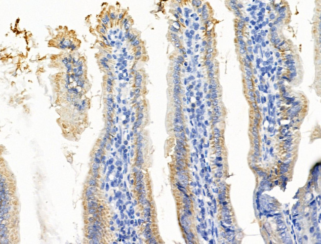 WIPI1 Antibody in Immunohistochemistry (Paraffin) (IHC (P))