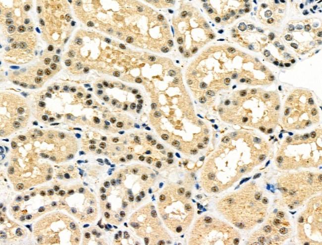 WT1 Antibody in Immunohistochemistry (Paraffin) (IHC (P))