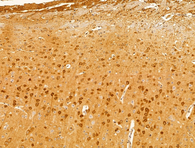 XAF1 Antibody in Immunohistochemistry (Paraffin) (IHC (P))