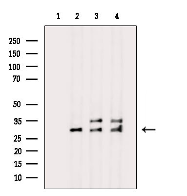 XCR1 Antibody in Western Blot (WB)