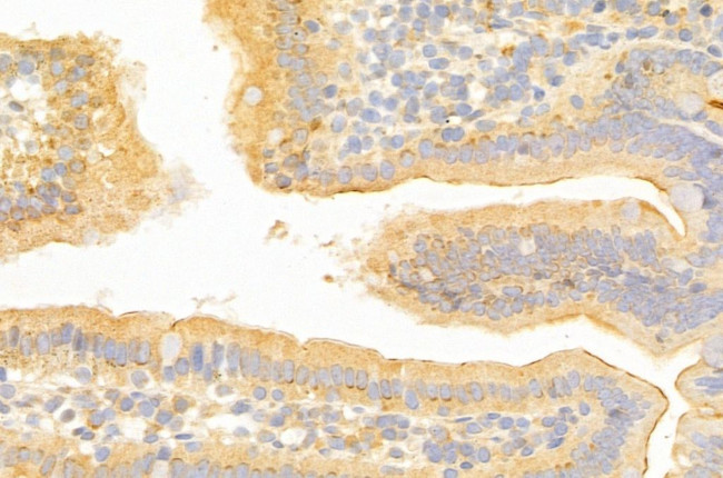 SLC7A11 Antibody in Immunohistochemistry (Paraffin) (IHC (P))