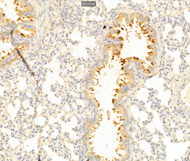 SLC7A11 Antibody in Immunohistochemistry (Paraffin) (IHC (P))