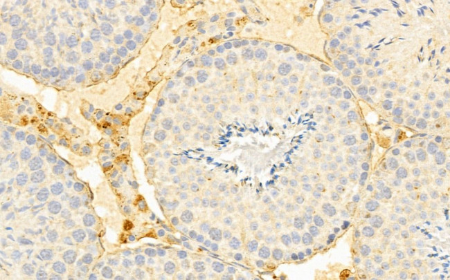 SLC7A11 Antibody in Immunohistochemistry (Paraffin) (IHC (P))