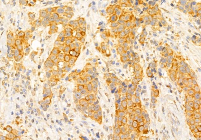 SLC7A11 Antibody in Immunohistochemistry (Paraffin) (IHC (P))