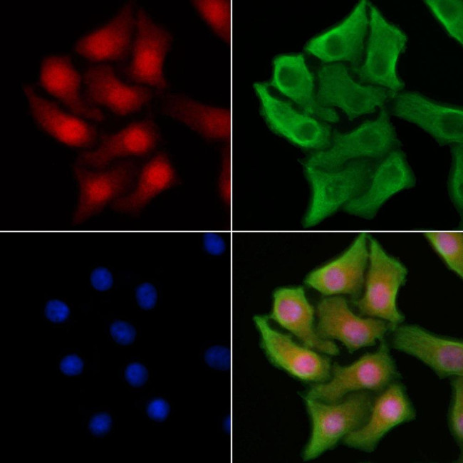 XRCC1 Antibody in Immunocytochemistry (ICC/IF)