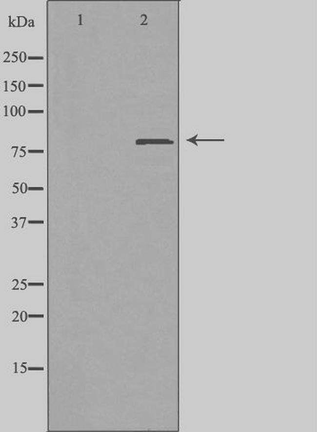 ZC3H11A Antibody in Western Blot (WB)