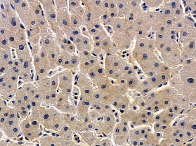 ZDHHC7 Antibody in Immunohistochemistry (Paraffin) (IHC (P))